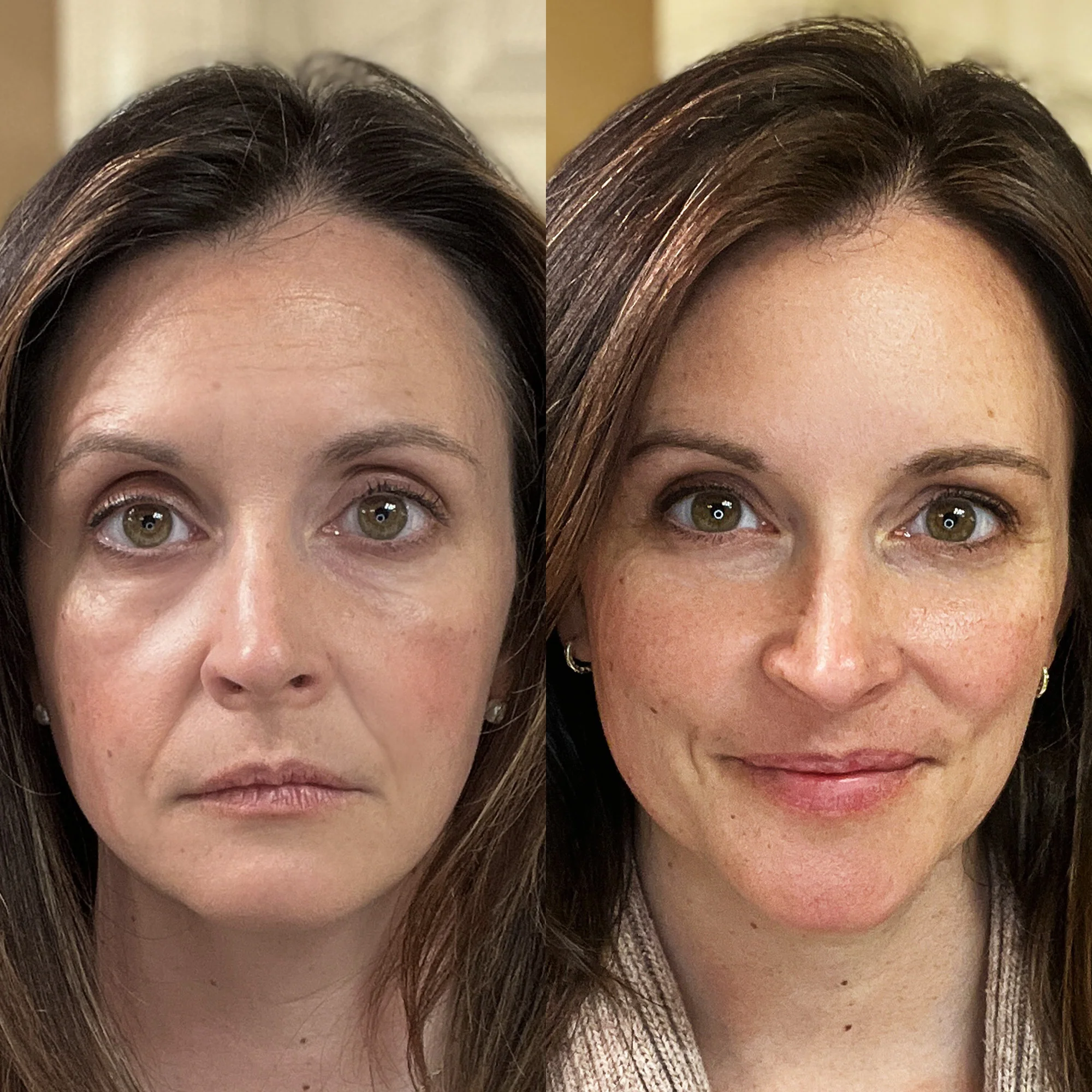 Contoura™ Chin & Neck Tightening Device - Multispecteral Light & EMS Microcurrents - Image 3
