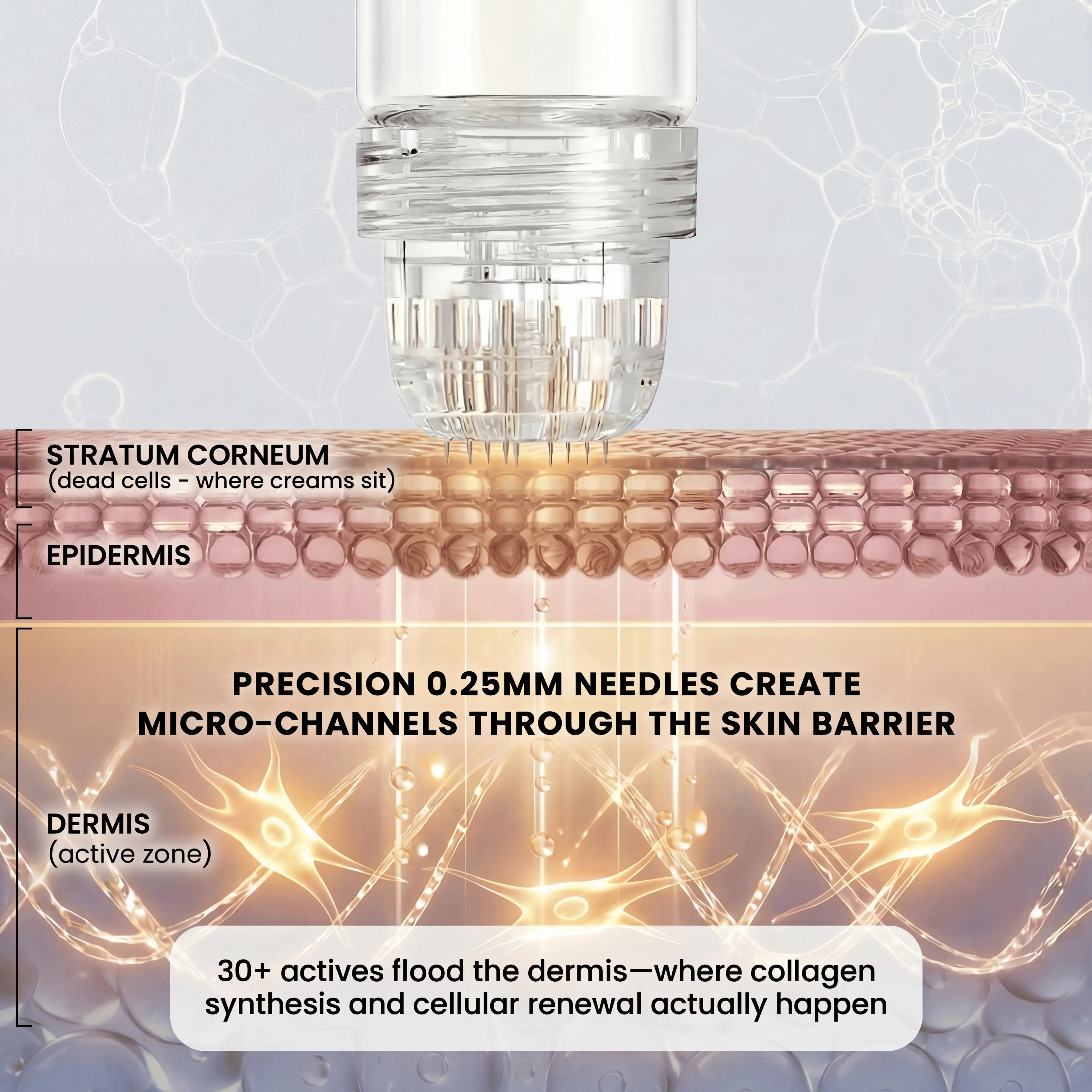 Micro-Infusion System For Smile Lines - Image 12