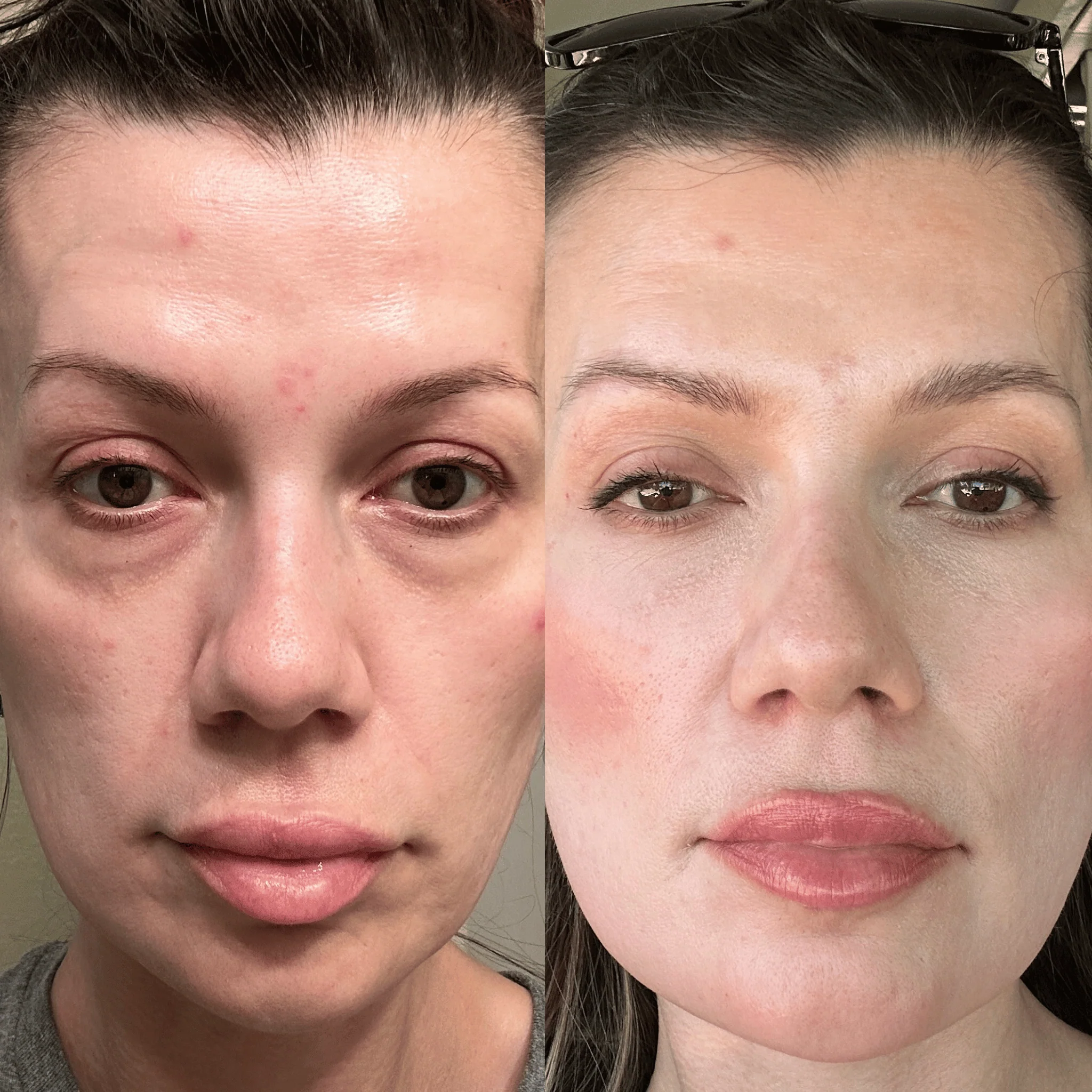 RevitalEyes® 2-in-1 Red Light Therapy & EMS Microcurrents For Eye Bags - Image 3