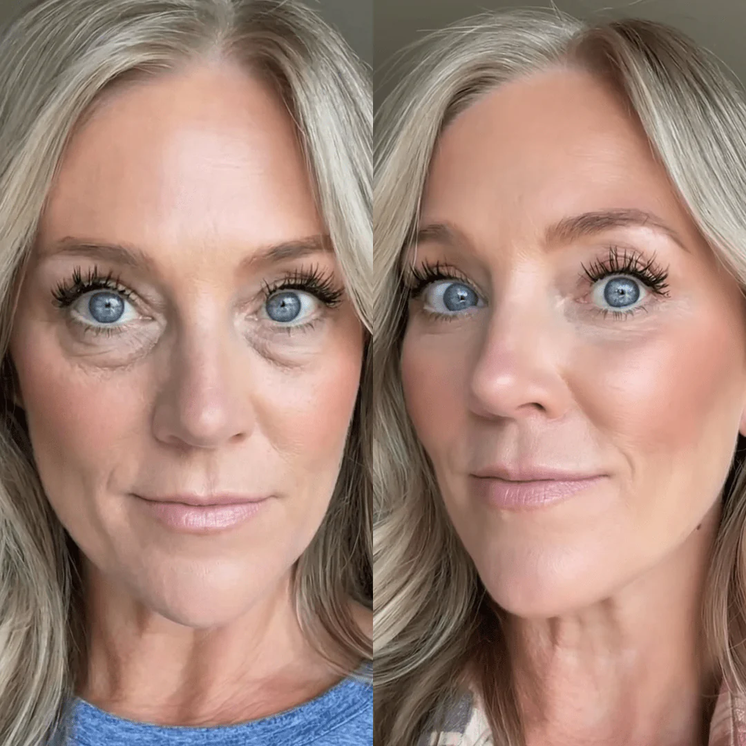 RevitalEyes® — Red Light & EMS Device for Hormone-Related Under-Eye Puffiness - Image 3