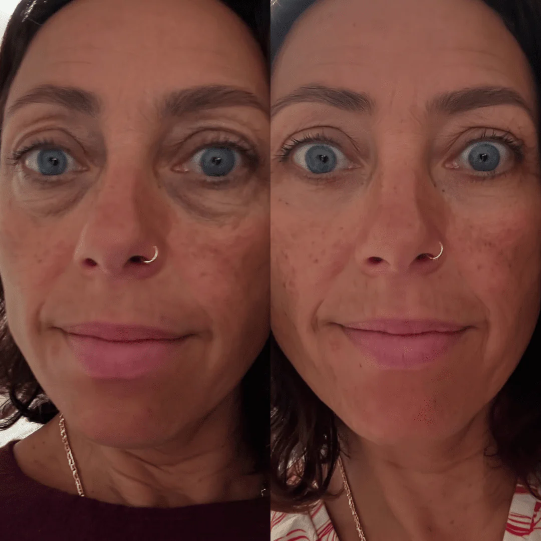 RevitalEyes® — Red Light & EMS Device for Hormone-Related Under-Eye Puffiness - Image 5
